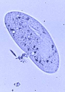 Paramecium caudatum. Image borrowed from A Blog Around the Clock.