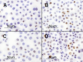 Cells stained for p53. Brown nuclei contain much p53 that is inactive. A and C are controls, B and D are treated with selenite. Sell the full paper for details (figure 2).